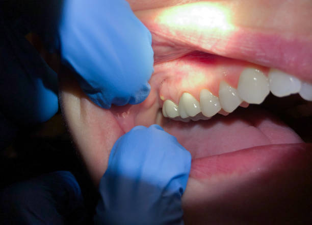Best Mobile Emergency Dentist in Bella Vista, AR
